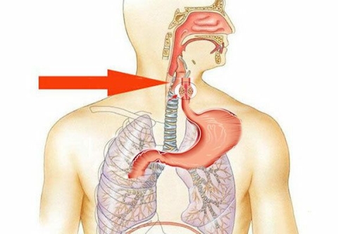 Hướng dẫn bệnh nhân sau mổ cắt thực quản điều trị ung thư thực quản